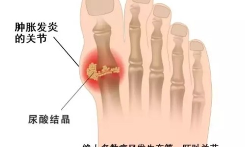 打篮球出汗对身体好吗-打篮球头部出汗多网—知名的打篮球出汗对身体好吗网站,分享打篮球出汗多是什么原因分析知识